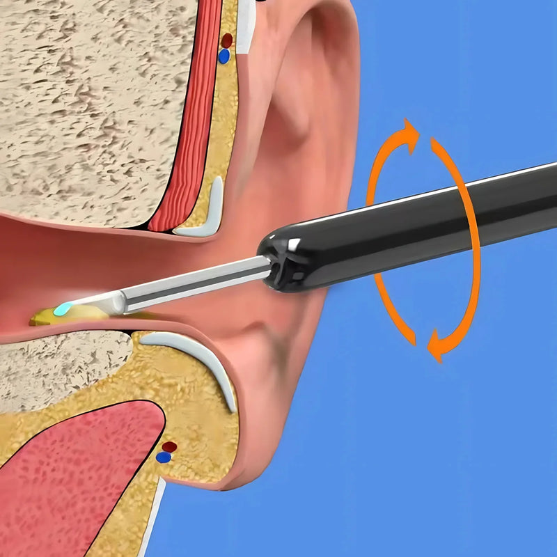 Wireless Ear Wax Cleaner with 1080p Camera