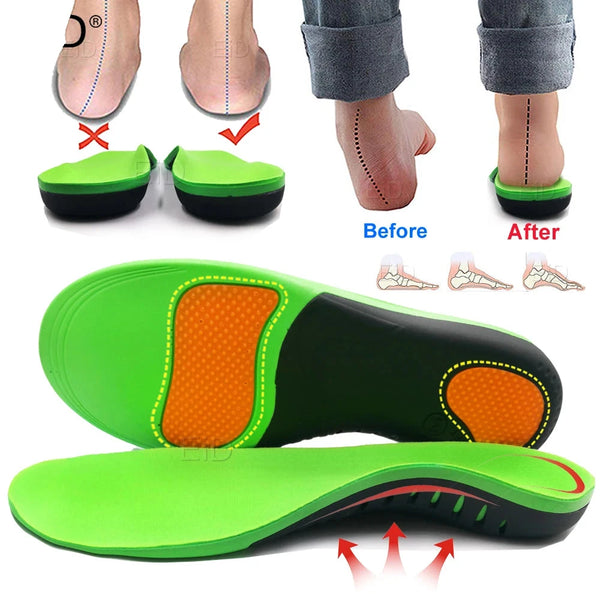 Super Comfortable Orthopedic Flat Feet Arch Support Insoles