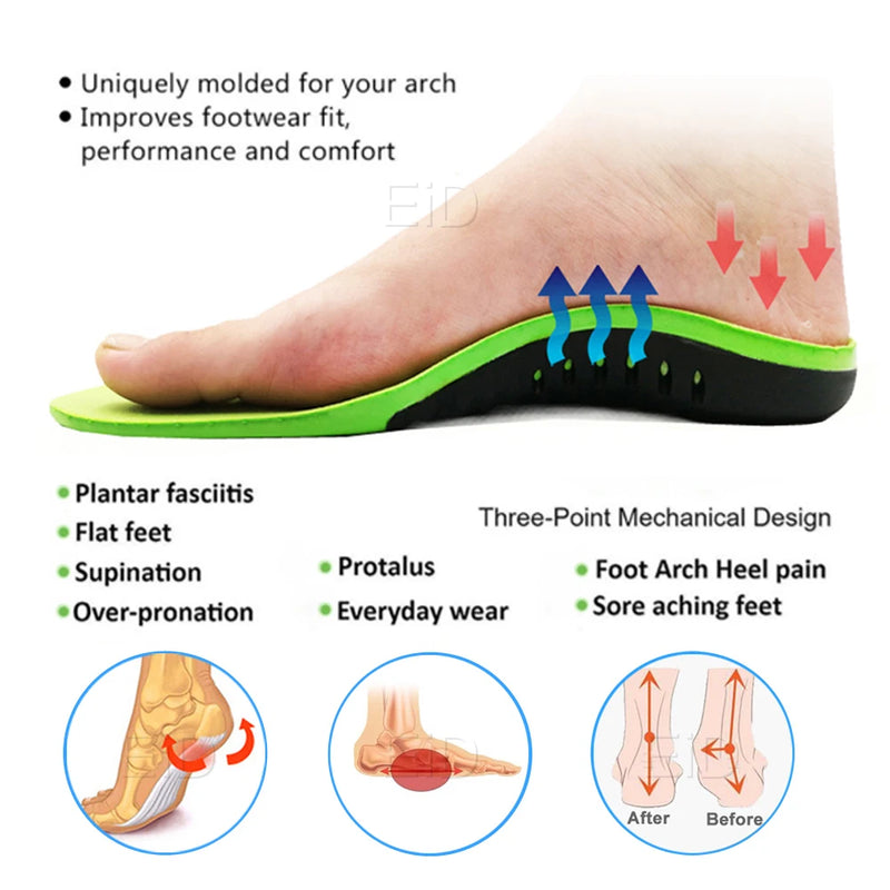 Super Comfortable Orthopedic Flat Feet Arch Support Insoles