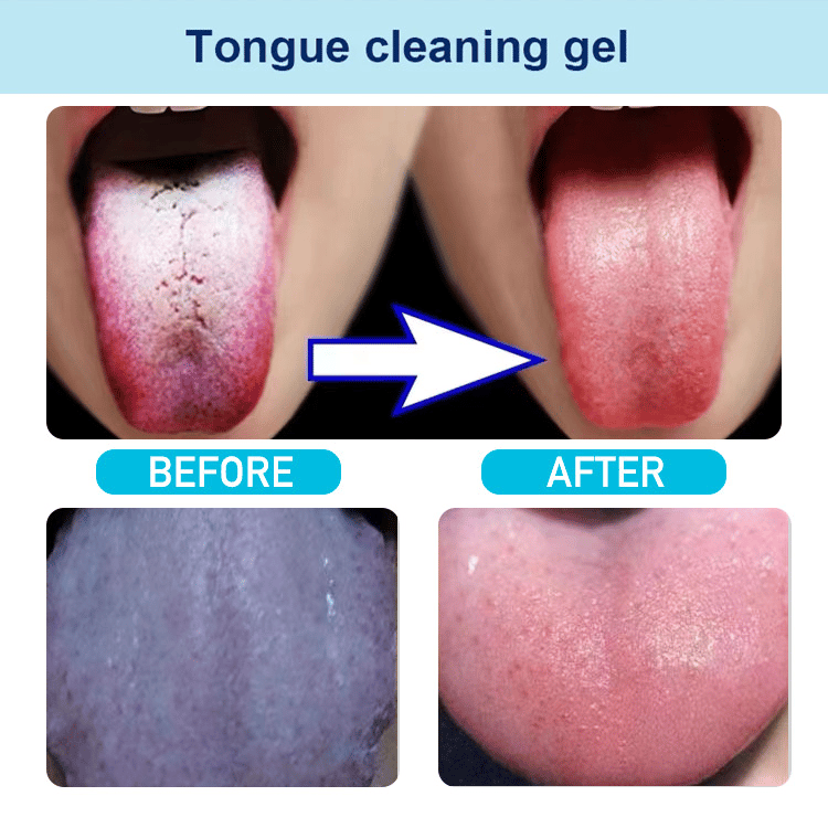 Probiotic Tongue Cleaning Gel Set